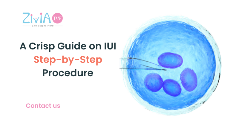 IUI Step-by-Step Procedure