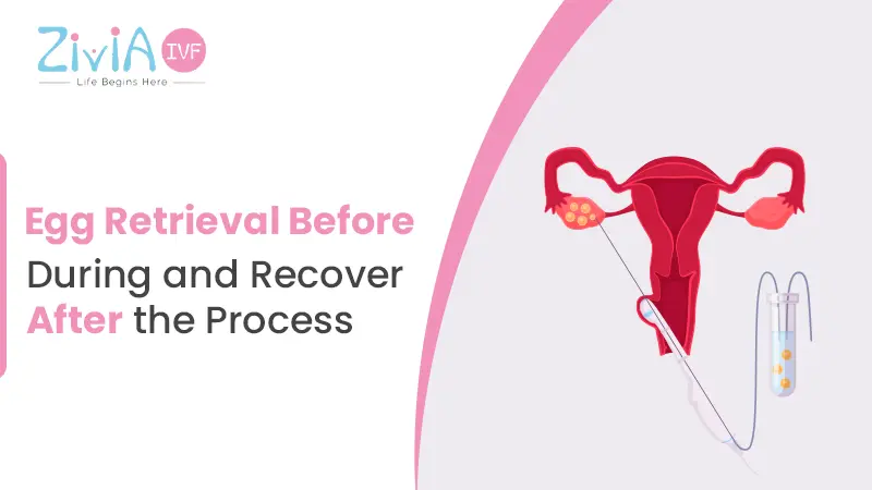 Egg Retrieval Ovum Pick Up - Before, During and Recovery after