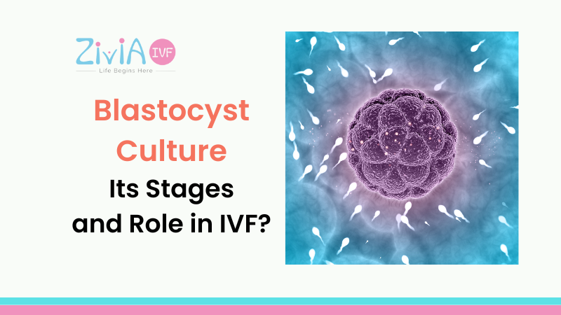 Blastocyst Culture, Its Stages and Role in IVF?