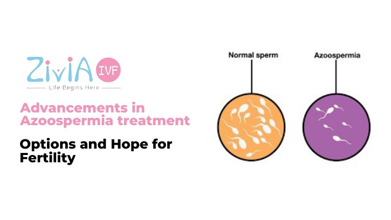 Advancements in Azoospermia Treatment: Options and Hope for Fertility